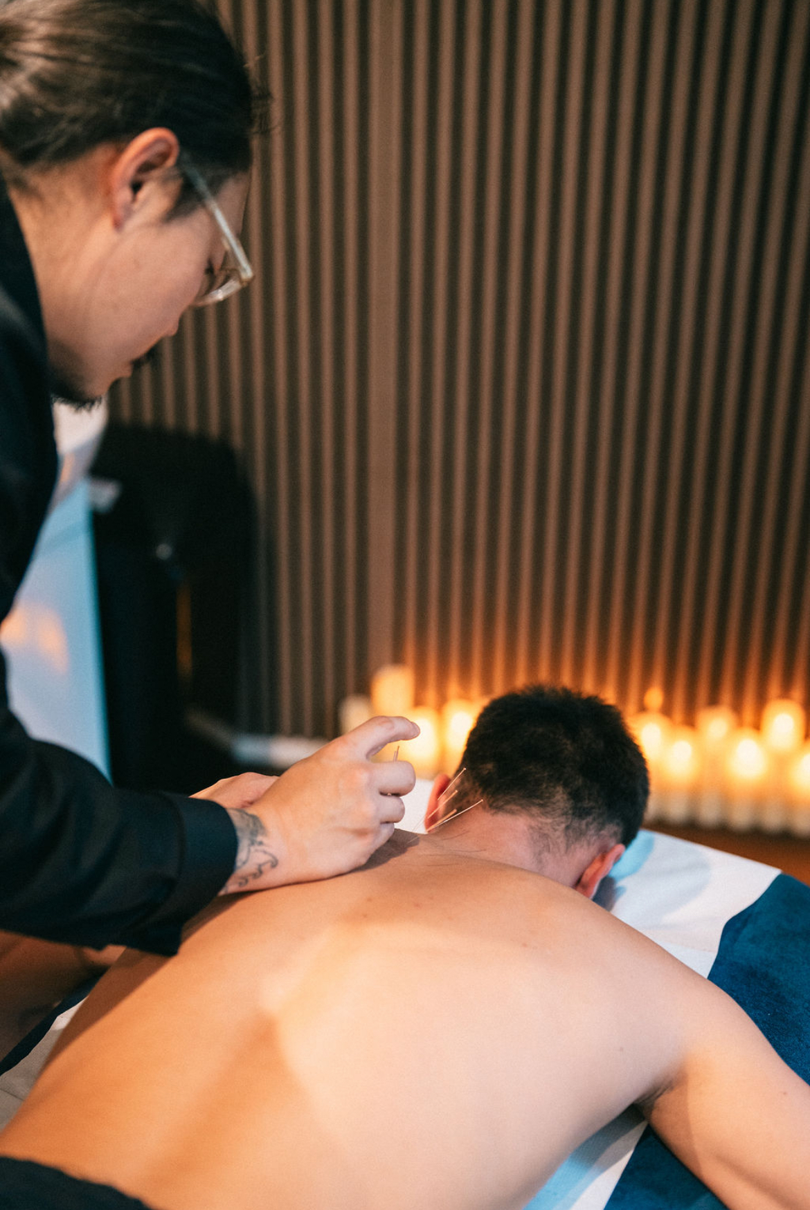 Dry needling treatment